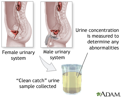 Urine concentration test