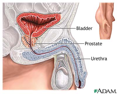 Prostatectomy - Series
