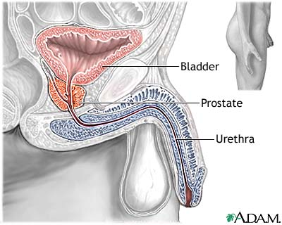 Transurethral Resection of the Prostate (TURP) - Series