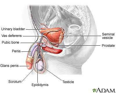 Prosztatadaganat prostatitis, ciszta, adenoma prosztata (hiperplázia), a rák