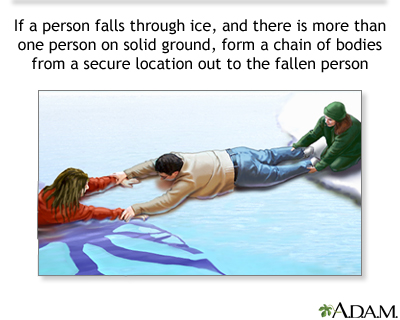 Drowning rescue on the ice, human chain