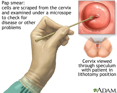 The Pap smear
