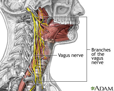 Role of the vegus nerve in epilepsy