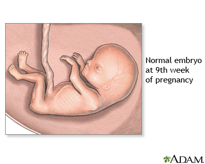 9 Week Old Fetus