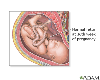 36 Week Old Fetus