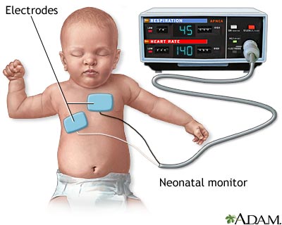Heart - respiratory monitor