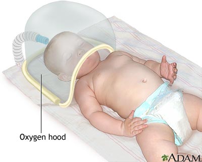 Oxygen hood