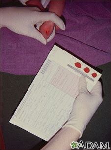 Phenylketonuria test