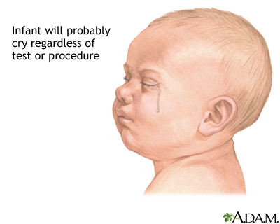 Infant test/procedure preparation