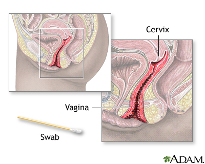 Pap smear