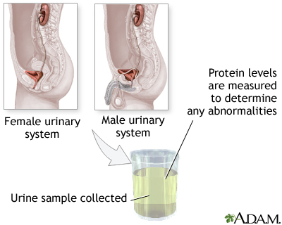 Protein urine test