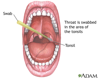 Throat swabs